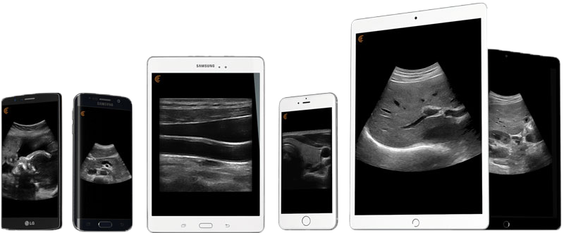 échographe portable clarius connecter mobile tablette