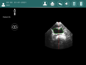 easyblad mesurer le volume du résodu post mictionnel ultrason